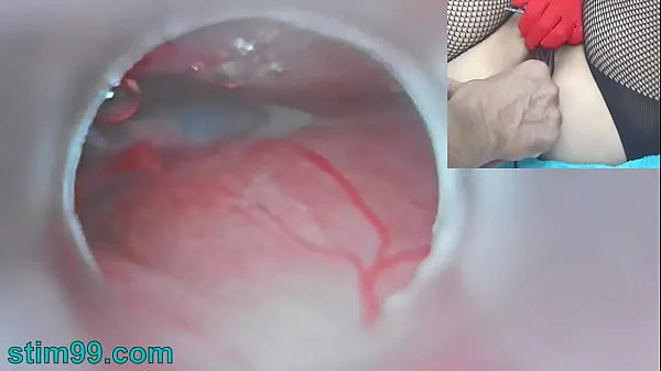 सर्वोत्तम Uncensored Japanese Insemination with Cum into Uterus and Endoscope Camera by Cervix to watch inside womb क्लिप्स क्लिप्स